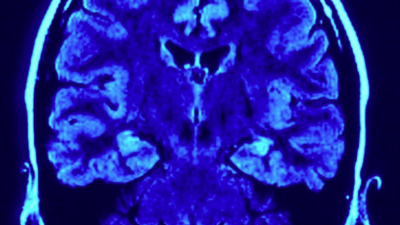 Istraživanje: Mozak prolazi kroz pet “era”, a adolescentska faza traje do ranih 30-ih