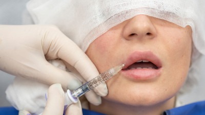 Nova pravila za estetske zahvate u FBiH