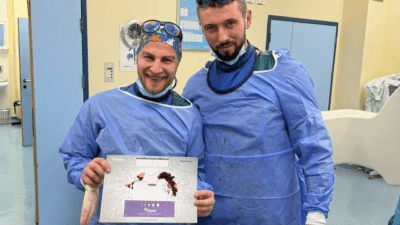 U KCUS-u izvedena prva mehanička trombektomija kod masivne plućne embolije