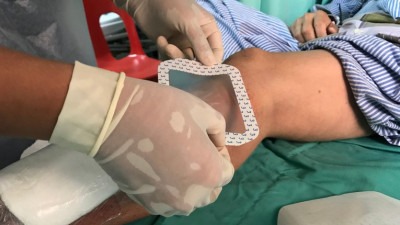 Otkriće američkih znanstvenika: Lijek za tlak ubija bakteriju otpornu na antibiotike